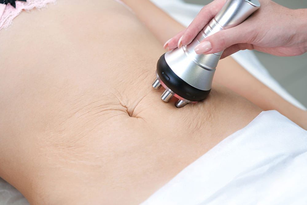 Facial Radiofrequency Perut