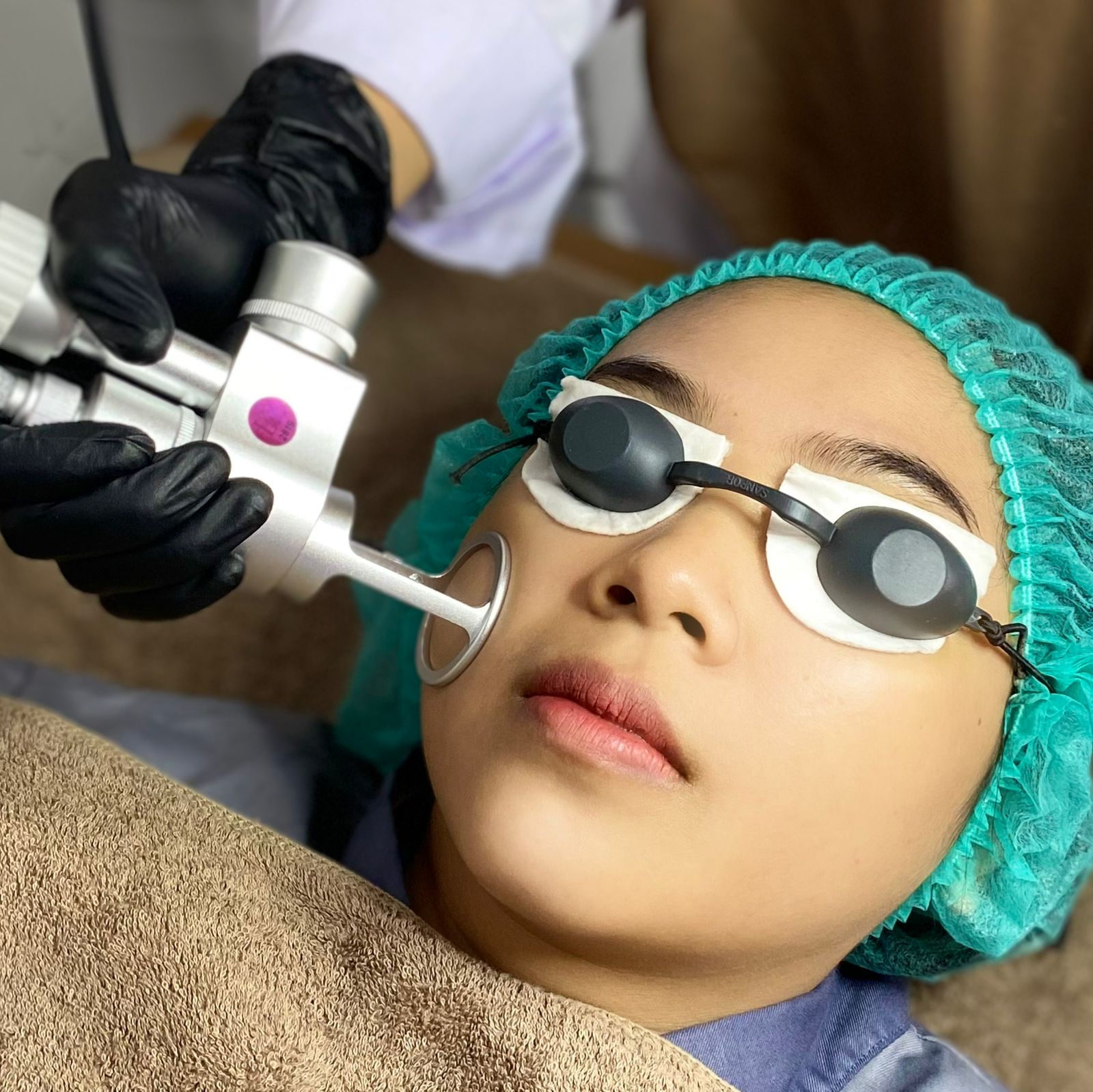Laser CO2 Fractional