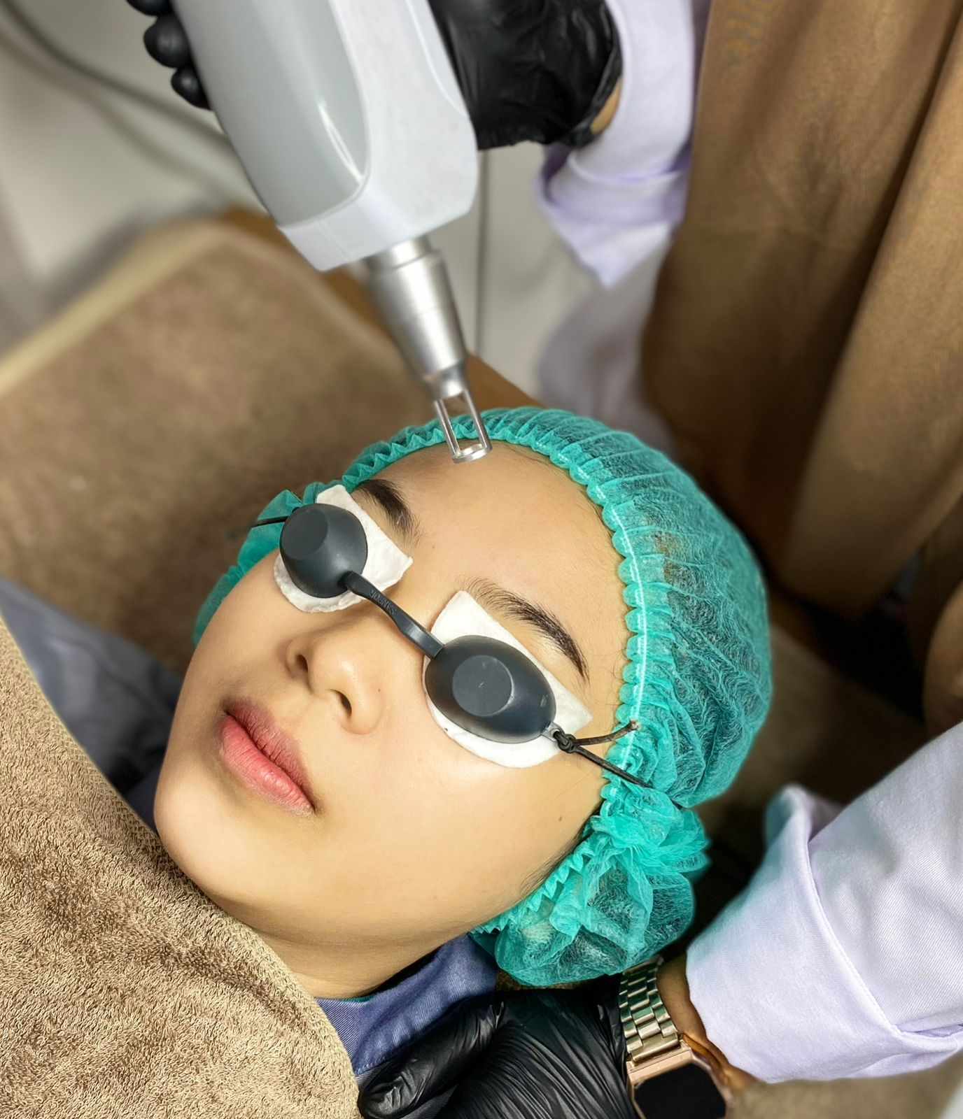 Laser Pico Korea Gold Whitening