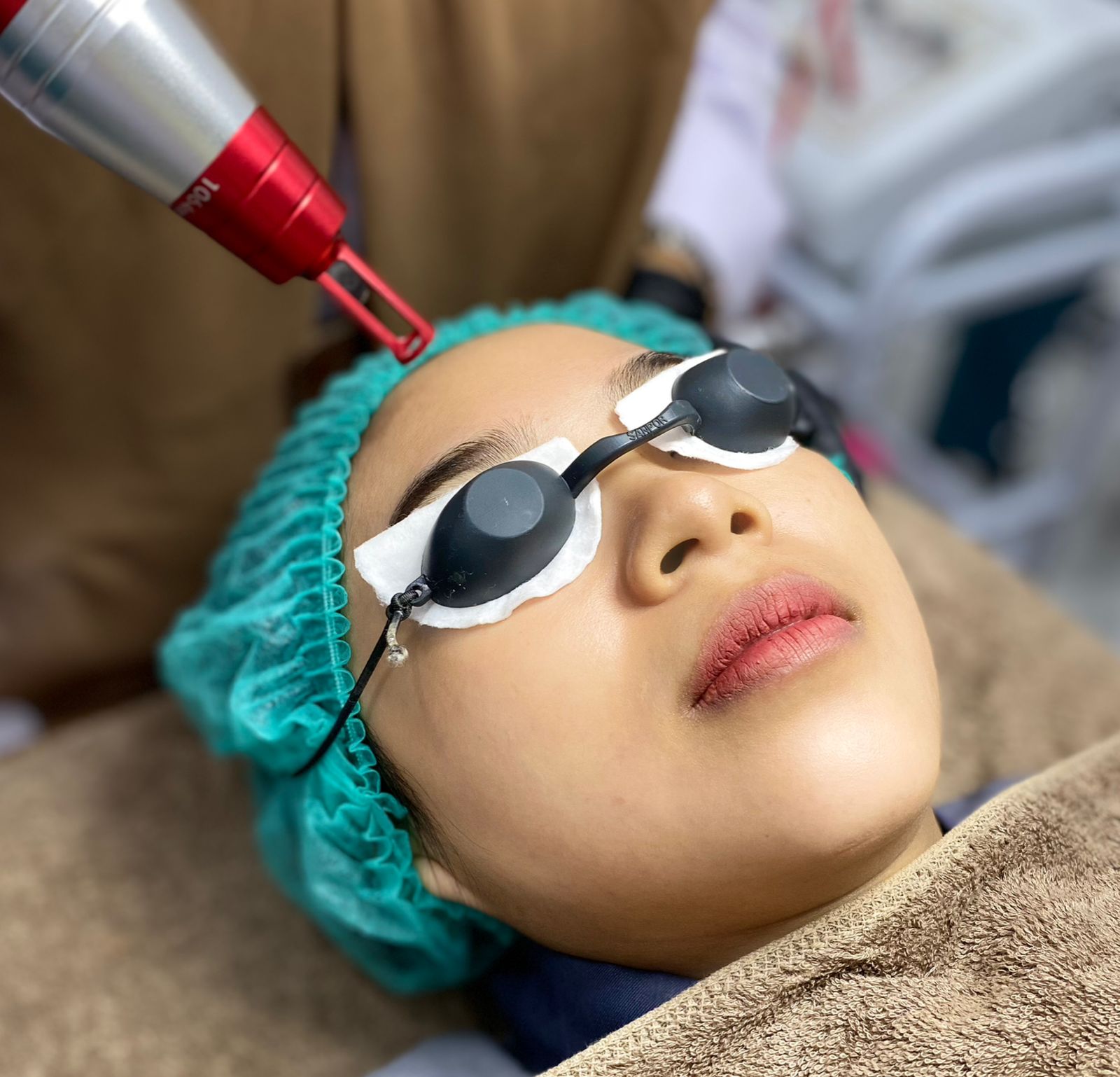 Laser Picosecond Gold Whitening