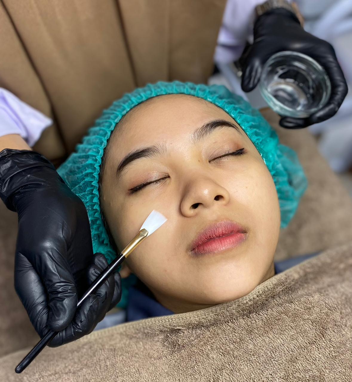 Peeling Baby Skin Free Facial