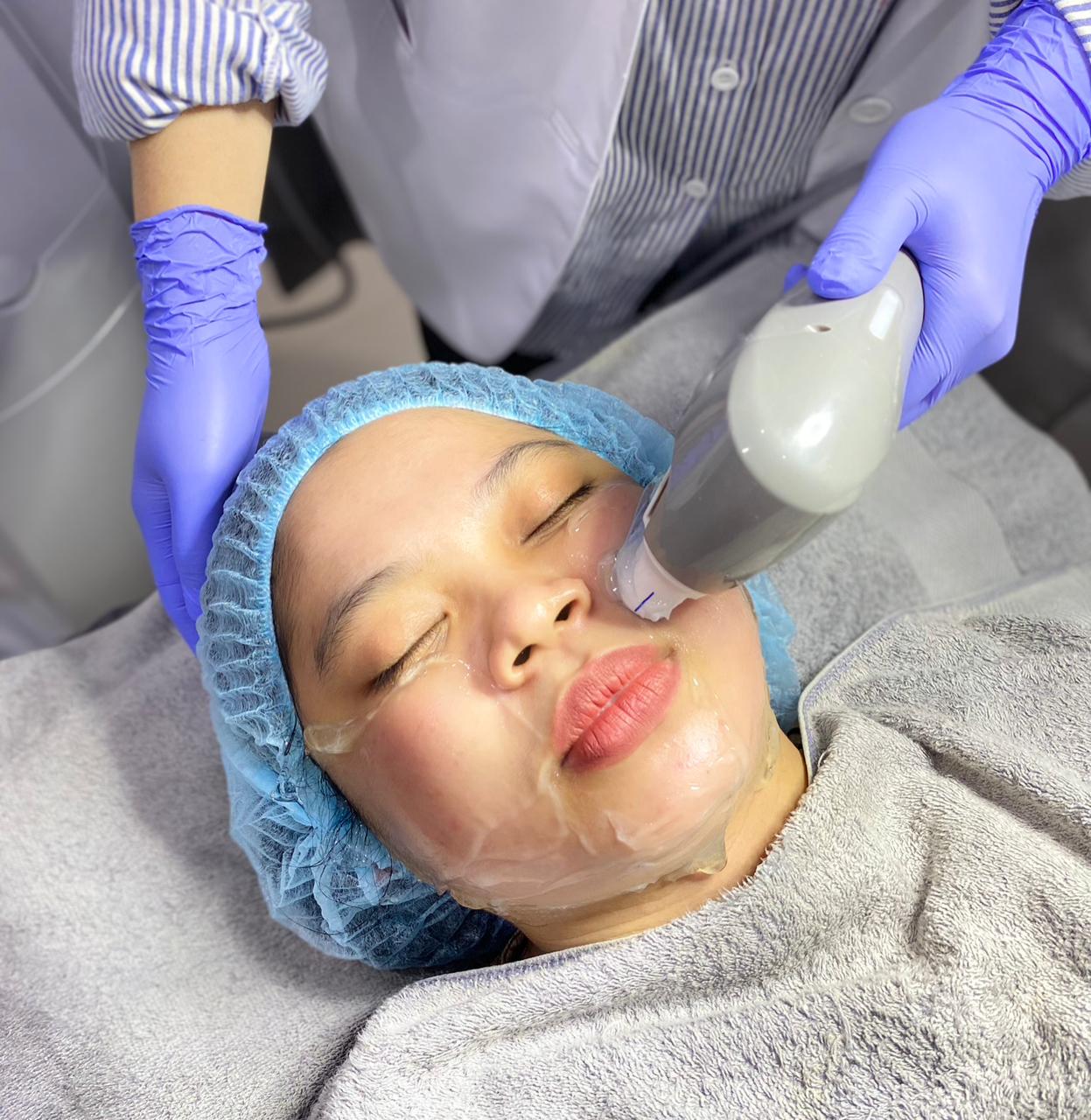 Ultraformer / HIFU 7D Face